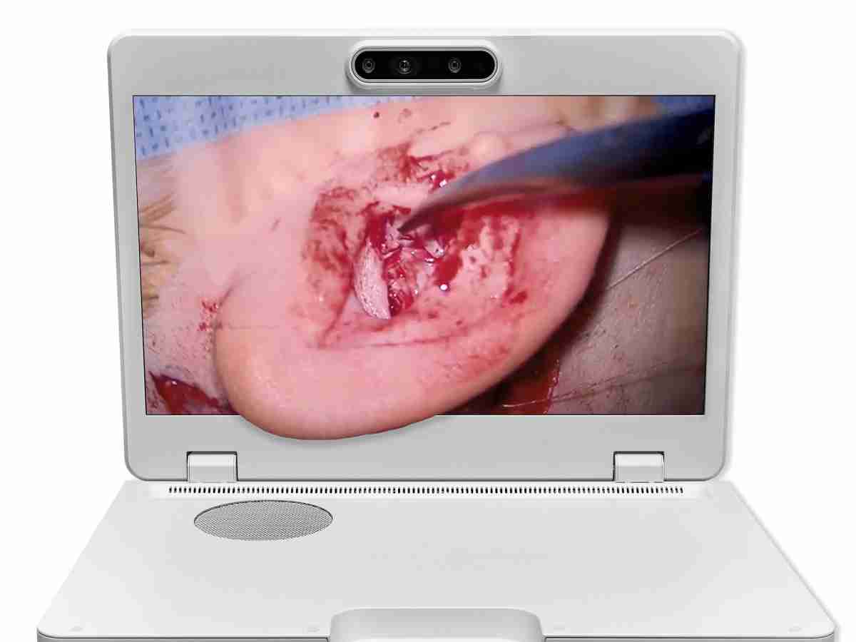 达擎之＂Heads-up 3D显微手术显示系统＂，，，整合4K裸眼3D显示及眼球追踪系统，，，具备快速追踪人眼移动位置功能，，减轻医师长时间维持固定姿势的负担，，，，让医师能有更宽广清晰的3D立体视野及更舒适的姿势来执行手术。。。